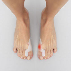 Silicone Bunion Corrector...